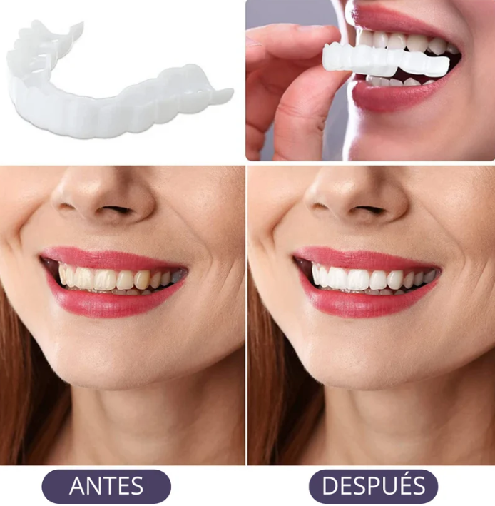 Tu sonrisa perfecta en segundos – Carillas Snapon Smile 🦷