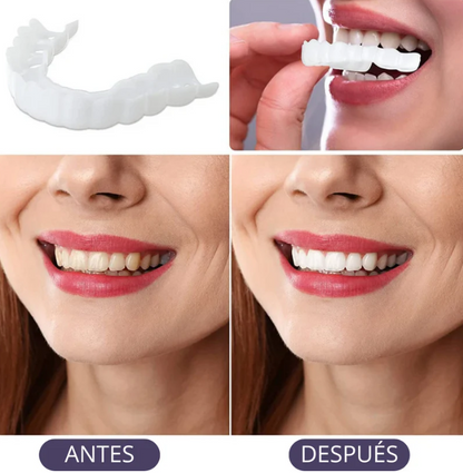 Tu sonrisa perfecta en segundos – Carillas Snapon Smile 🦷